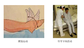 圍術(shù)期患者VTE的預(yù)防，只知道抗凝可不行