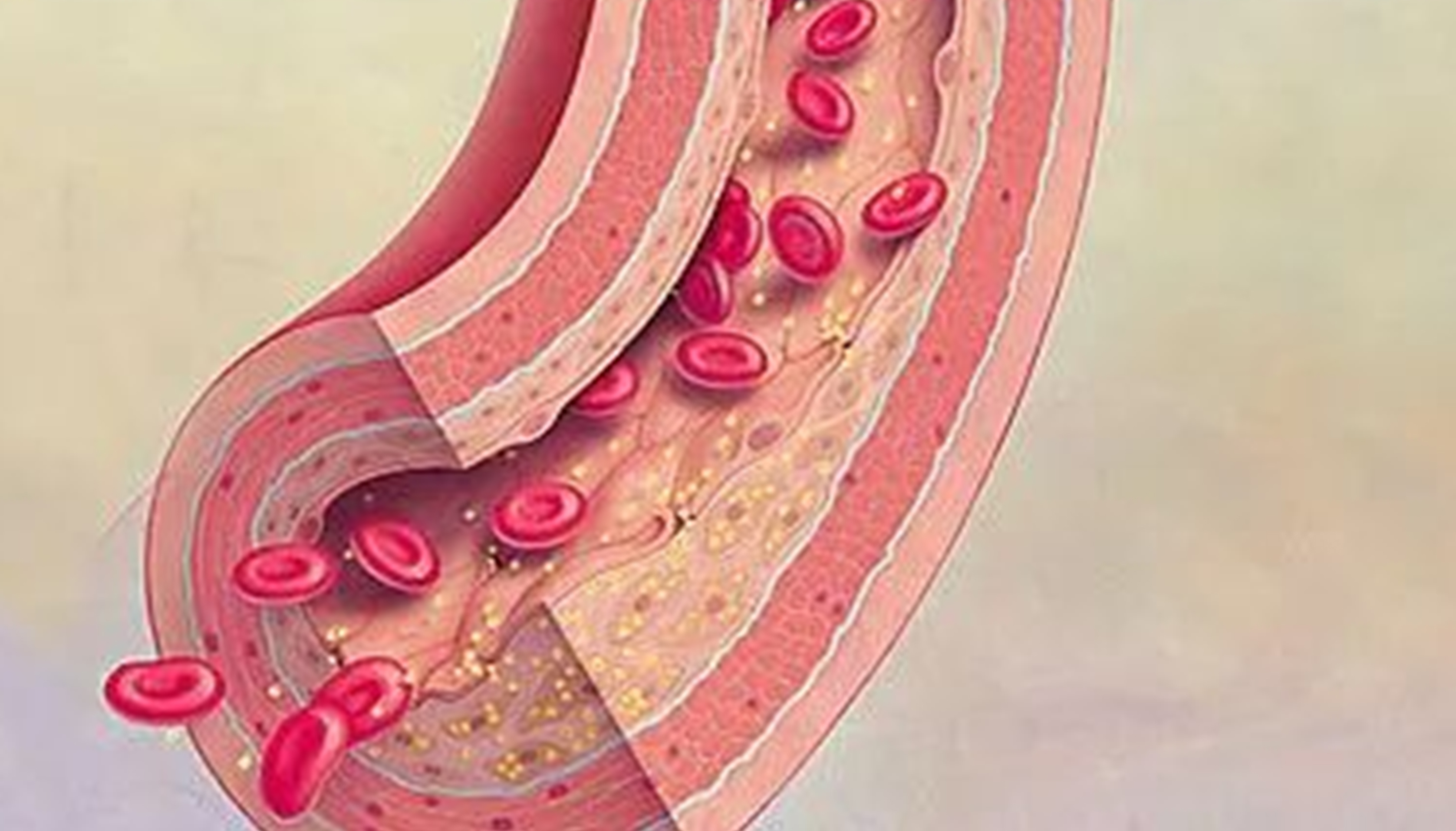 血栓形成，三個(gè)要素細(xì)分說