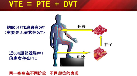 什么是臨床上一致公認(rèn)的VTE防治基礎(chǔ)？