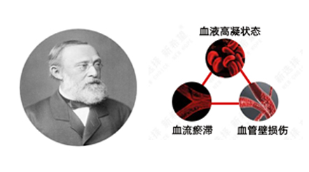 揭秘血栓形成的“幕后黑手”：魏爾嘯三要素帶你讀懂血管健康密碼