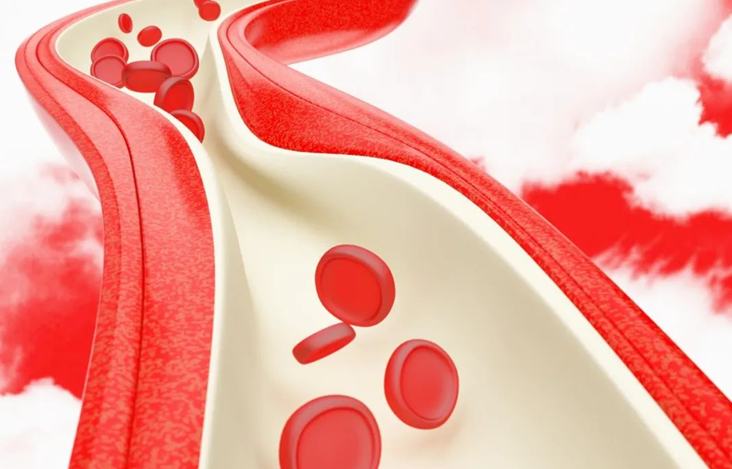 血栓危害大，預(yù)防有辦法