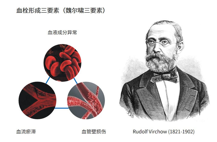 世界血栓日 | 拴不住，動起來