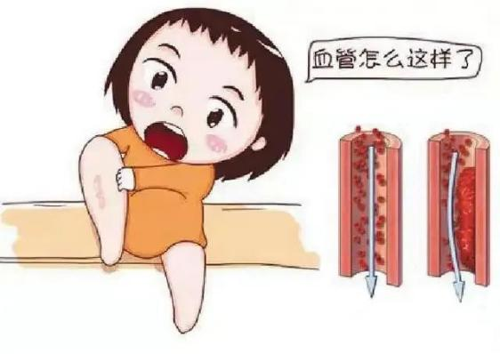 腫瘤不容忽視的第二號(hào)殺手—VTE，該如何防治？