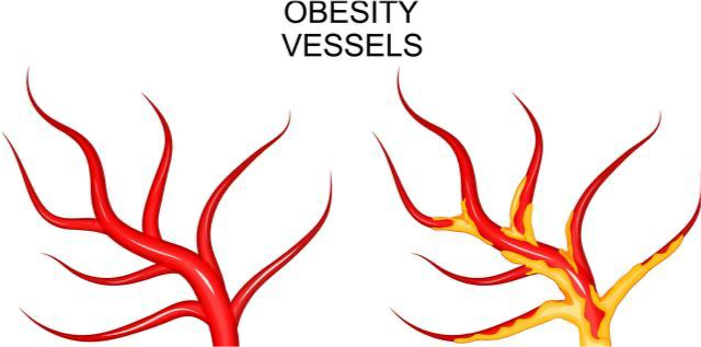 老年人如何預(yù)防下肢靜脈血栓 哪些癥狀提示下肢靜脈有血栓了 老年人如何預(yù)防下肢靜脈血栓 哪些癥狀提示下肢靜脈有血栓了