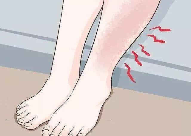 下肢水腫—當(dāng)心 下肢水腫—當(dāng)心