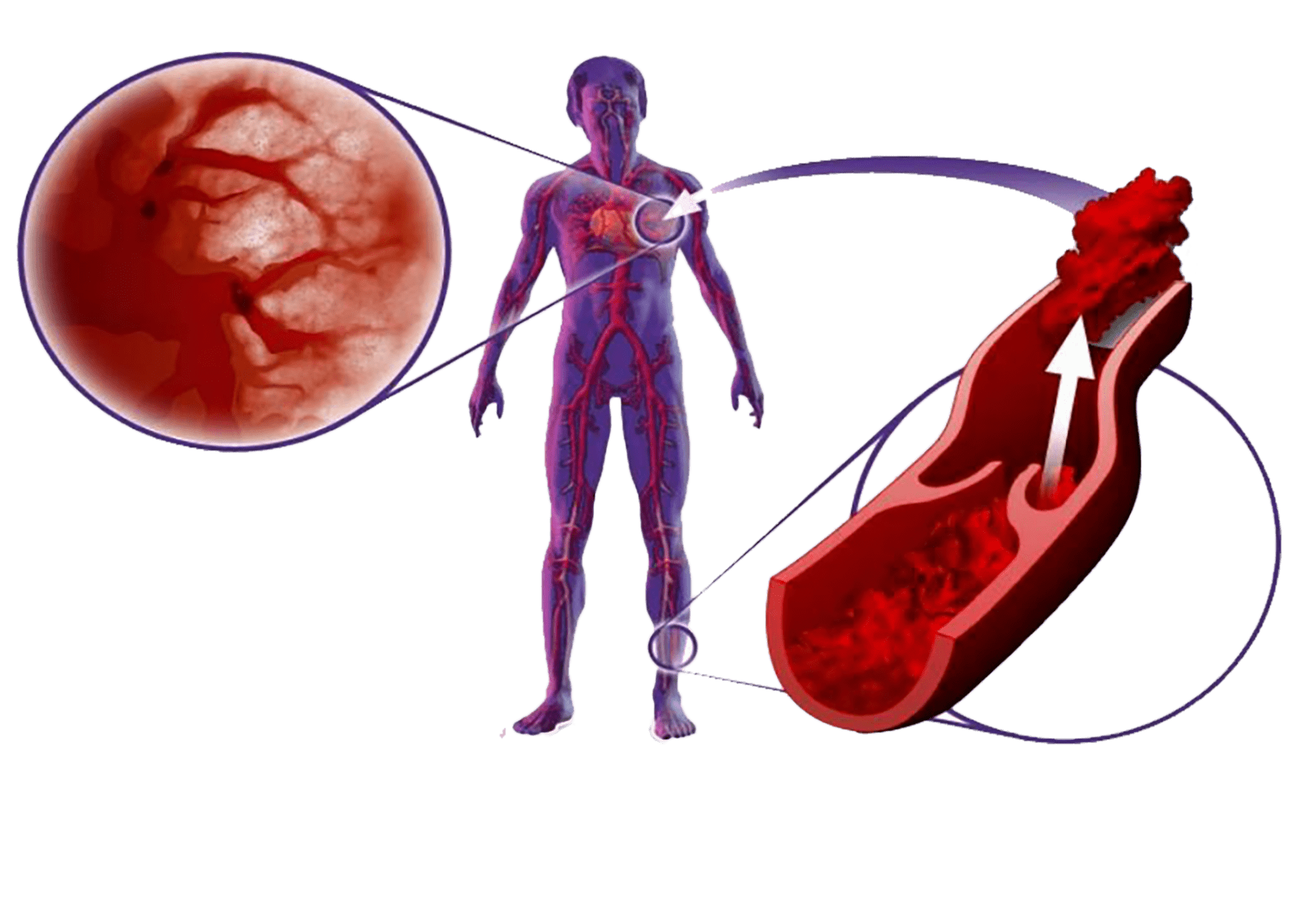 下肢水腫—當(dāng)心 下肢水腫—當(dāng)心