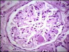 世界血栓日來(lái)臨之際 共話(huà)血栓的前世今生